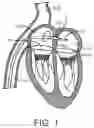 Fig. 02 - Support devices for transcatheter delivery system handles