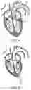 Fig. 04 - Support devices for transcatheter delivery system handles