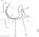 Fig. 03 - Heart valve treatment device and method