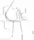 Fig. 05 - Heart valve treatment device and method