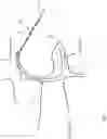 Fig. 06 - Heart valve treatment device and method