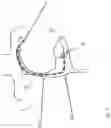Fig. 07 - Heart valve treatment device and method