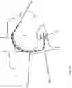 Fig. 14 - Heart valve treatment device and method
