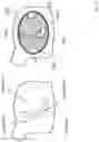 Fig. 22 - Heart valve treatment device and method