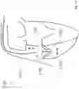 Fig. 30 - Heart valve treatment device and method