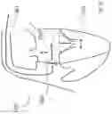 Fig. 32 - Heart valve treatment device and method