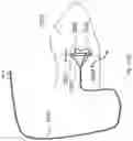 Fig. 37 - Heart valve treatment device and method