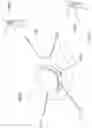 Fig. 48 - Heart valve treatment device and method