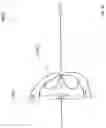 Fig. 52 - Heart valve treatment device and method