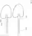 Fig. 56 - Heart valve treatment device and method