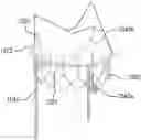 Fig. 01 - Self-assembling modular percutaneous valve and methods of folding, assembly and delivery