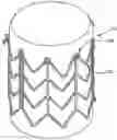 Fig. 01 - Stents for Prosthetic Heart Valves