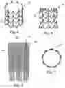 Fig. 03 - Stents for Prosthetic Heart Valves