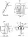 Fig. 05 - Stents for Prosthetic Heart Valves