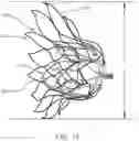 Fig. 15 - Prosthetic Mitral Valves And Apparatus And Methods For Delivery Of Same