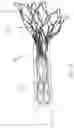 Fig. 19 - Prosthetic Mitral Valves And Apparatus And Methods For Delivery Of Same