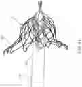 Fig. 21 - Prosthetic Mitral Valves And Apparatus And Methods For Delivery Of Same