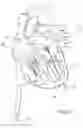 Fig. 22 - Prosthetic Mitral Valves And Apparatus And Methods For Delivery Of Same
