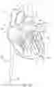 Fig. 23 - Prosthetic Mitral Valves And Apparatus And Methods For Delivery Of Same