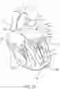 Fig. 24 - Prosthetic Mitral Valves And Apparatus And Methods For Delivery Of Same