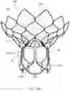Fig. 29 - Prosthetic Mitral Valves And Apparatus And Methods For Delivery Of Same