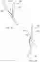 Fig. 32 - Prosthetic Mitral Valves And Apparatus And Methods For Delivery Of Same