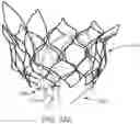 Fig. 33 - Prosthetic Mitral Valves And Apparatus And Methods For Delivery Of Same