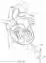 Fig. 45 - Prosthetic Mitral Valves And Apparatus And Methods For Delivery Of Same