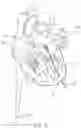 Fig. 48 - Prosthetic Mitral Valves And Apparatus And Methods For Delivery Of Same