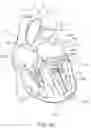Fig. 49 - Prosthetic Mitral Valves And Apparatus And Methods For Delivery Of Same