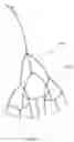 Fig. 50 - Prosthetic Mitral Valves And Apparatus And Methods For Delivery Of Same