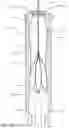 Fig. 54 - Prosthetic Mitral Valves And Apparatus And Methods For Delivery Of Same