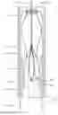 Fig. 62 - Prosthetic Mitral Valves And Apparatus And Methods For Delivery Of Same