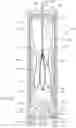 Fig. 64 - Prosthetic Mitral Valves And Apparatus And Methods For Delivery Of Same