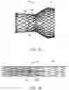 Fig. 02 - Transcatheter prosthetic heart valve delivery system with lateral offset control