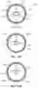 Fig. 16 - Transcatheter prosthetic heart valve delivery system with lateral offset control