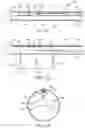Fig. 17 - Transcatheter prosthetic heart valve delivery system with lateral offset control