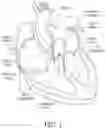 Fig. 02 - Prosthetic mitral valve holders