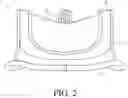 Fig. 03 - Prosthetic mitral valve holders