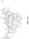 Fig. 07 - Prosthetic mitral valve holders