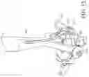 Fig. 14 - Prosthetic mitral valve holders