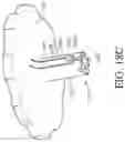 Fig. 25 - Prosthetic mitral valve holders