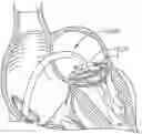 Fig. 01 - Heart valve docking devices and systems