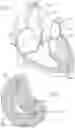 Fig. 02 - Heart valve docking devices and systems