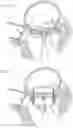 Fig. 06 - Heart valve docking devices and systems