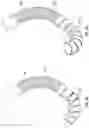 Fig. 06 - Cardiac valve delivery devices and systems