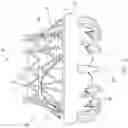 Fig. 03 - Delivery system for aided replacement valve recapture and repositioning post-deployment