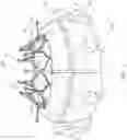 Fig. 06 - Delivery system for aided replacement valve recapture and repositioning post-deployment