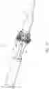 Fig. 27 - Delivery system for aided replacement valve recapture and repositioning post-deployment