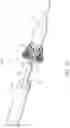 Fig. 28 - Delivery system for aided replacement valve recapture and repositioning post-deployment